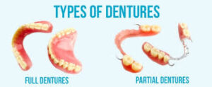 Full and Partial Dentures